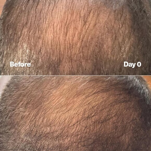 SickScience PowerCycle Scalp Treatment Serum – Hair Growth & Strength Booster - Picture 8 of 13